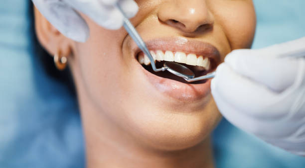 Best Emergency Wisdom Teeth Removal in Whitefish, MT